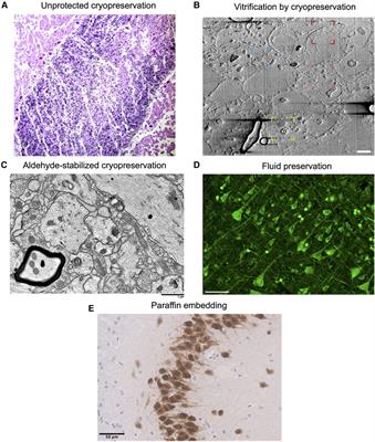 Structural brain preservation: a potential bridge to future medical technologies